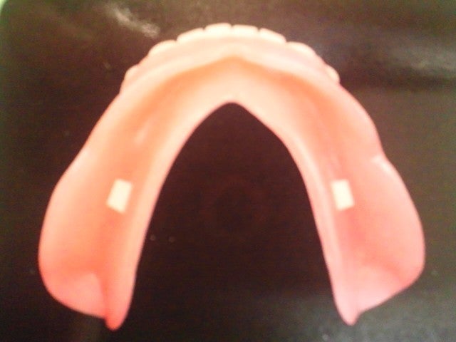 仮 歯 取れ た 応急 処置 ポリ グリップ