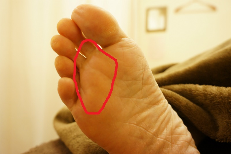足 の 指先 痛み ピリピリ