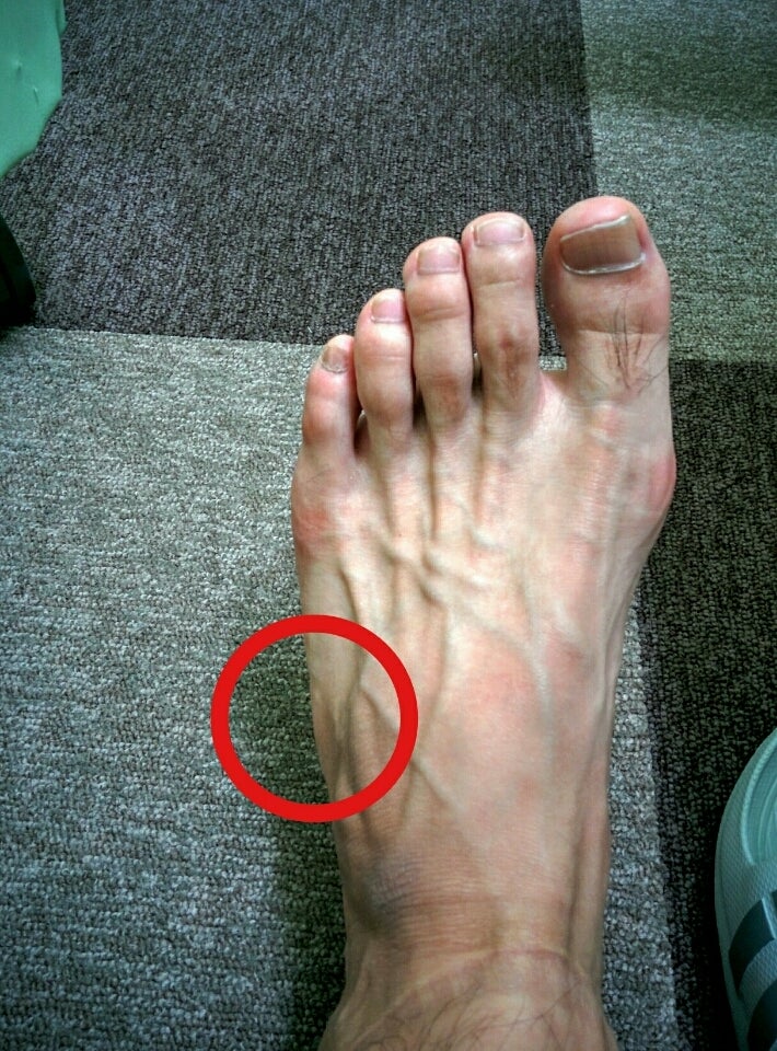 足の小指