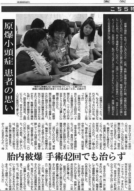 語り続ける原爆小頭症の患者さんたち_1