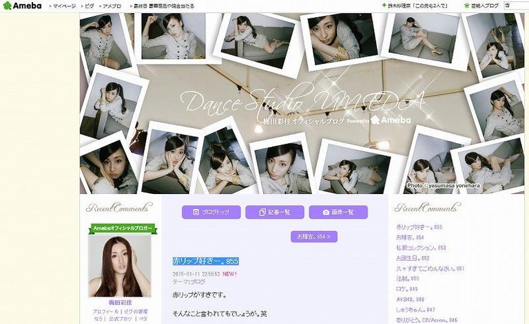 NMB48の梅田彩佳　顔面に大量の鍼が刺さった写真公開