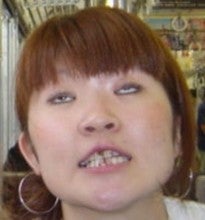 歯チョコ温子