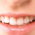 歯並びは家庭運、結婚運を反映　歯が多いと健康寿命長いの記事より