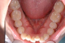 もりやま歯科医院のブログ