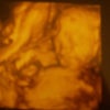 【24w】7ヶ月妊婦検診（画像あり）の画像