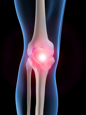 ■ひざ関節痛は軟骨の磨耗が影響していますの記事より