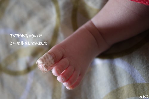 [最も人気のある！] 赤ちゃん 足の爪 719581赤ちゃん 足の爪 埋まってる Gambarjaya2jp