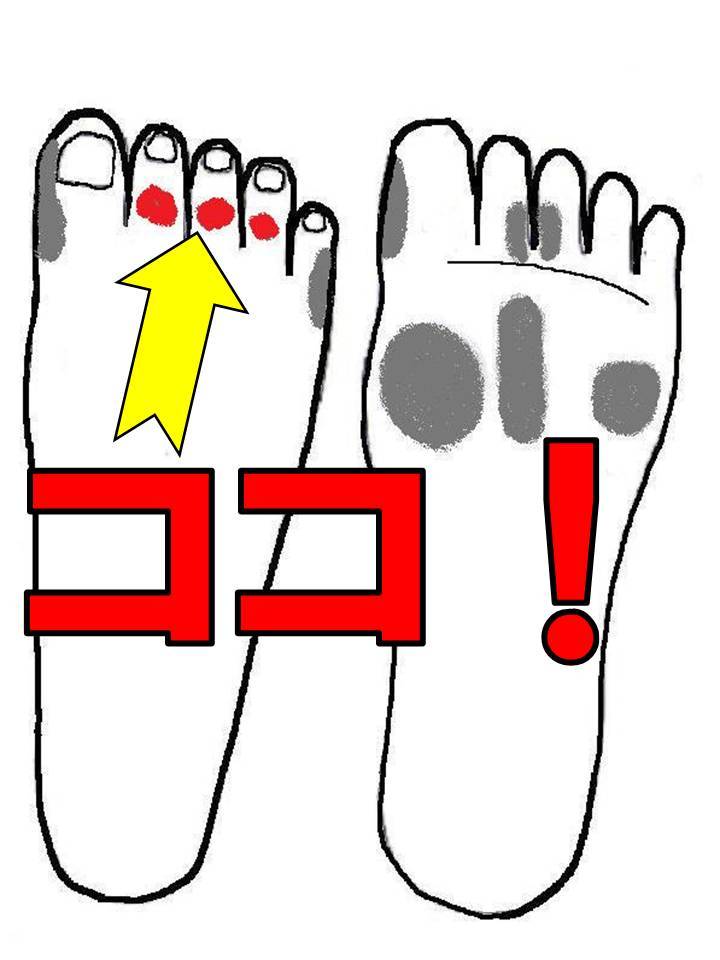 薬指 足 の 指 痛い 足の指を骨折した場合(またはひび)の症状6つと対処法2選