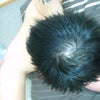 ハゲがやべぇ(*T□T*の画像