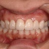 審美歯科をお考えの方　まずは無料カウンセリングをの画像
