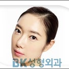 ほうれい線プロテーゼ（鼻翼基部プロテーゼ）韓国/美容整形/BKトンヤン/BK美容外科の記事より