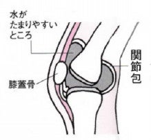 川本治療院　純さん先生-膝　関節水腫