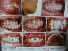 rita dental clinic blog