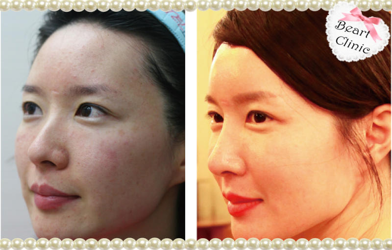 韓国の美容整形外科・美容皮膚科で働く女の日記