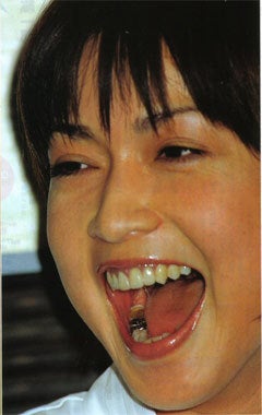 京子 虫歯 写真 長谷川