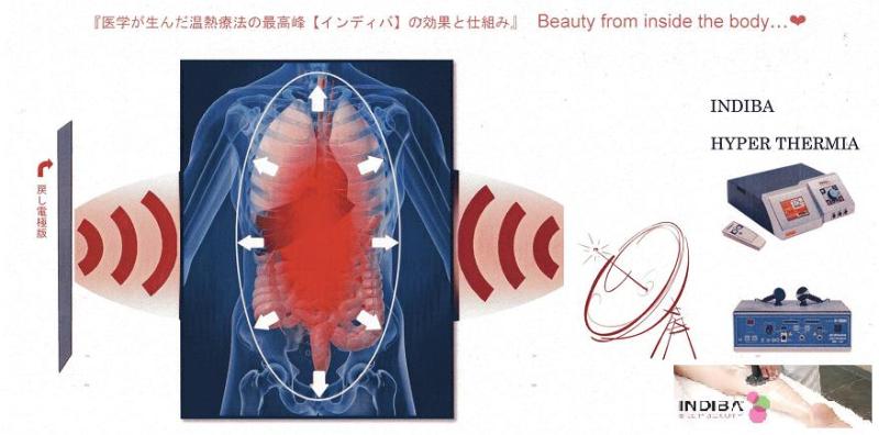 ☆INDIBA インディバとは☆ Beauty from inside the body...❤の記事より