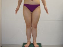 20歳女性 155㎝53㎏とても太い太ももをベイザーで美脚へ 1 ダウン ...
