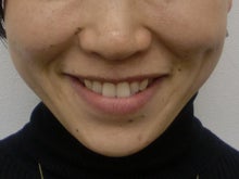 表情筋トレーニングで健康的な美しい顔を目指す！フェイスニング講師石田隆子～カラのブログ～