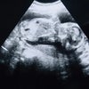 初めての胎動♪の画像
