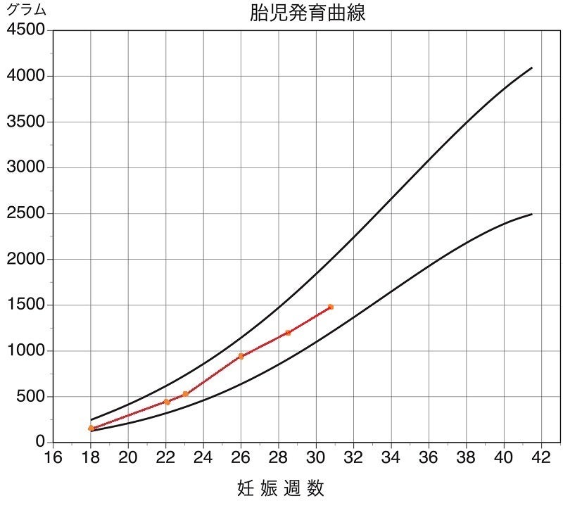 30 週 体重