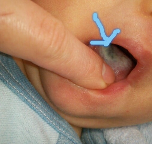 点 黒い 赤ちゃん 舌