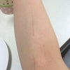 やられたり〜の画像