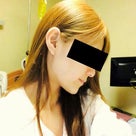 ID美容外科。韓国美容整形。日本人整形手術。整形ビフォーアフター（頬骨縮小術、Vライン手術）の記事より