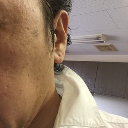 画像 「こ・い・つ」のおかげ？ の記事より 3つ目