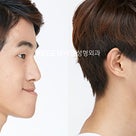 リゼン整形外科(REGEN整形外科)の男性の両顎手術(韓国美容整形・症例写真)の記事より