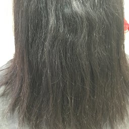 画像 多毛症？ の記事より 2つ目