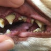 歯の手入れの重要性の画像