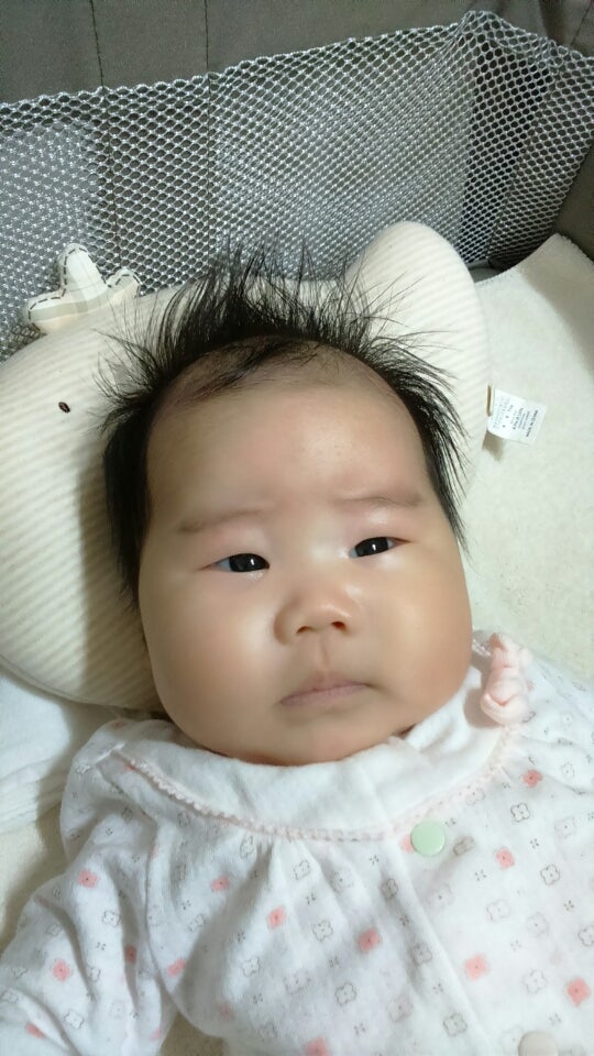 赤ちゃん 鼻が低い 228355赤ちゃん 鼻が低い ダウン症 Imagejoshxqr