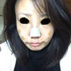 【レポ】湘南美容外科品川院で鼻の軟骨移植と目の下の脂肪除去~続編～の画像