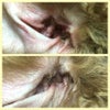 外耳炎の画像