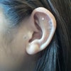 鍼灸師の治療に使う耳つぼです。「ダイエット」の耳つぼの画像