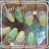 爽やかネイル(#^.^#)♡松山市のネイルサロン♡の画像