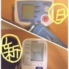 新旧血圧計の画像