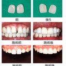 【江南/病院】白くて美しい歯になろう！「インプランティア歯科三成店」の記事より