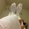 掌蹠膿疱症 入院の画像
