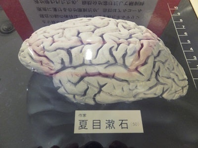 いろいろ 夏目漱石 脳 347275-夏目漱石 脳 なぜ