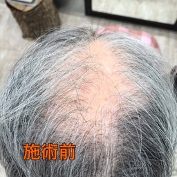 {BFE6CFD9-63CF-4BDB-AFA6-98E093845EA4}
