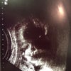 妊婦検診 32wの画像