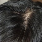 ”頭皮のエイジング予防をし始めました。”11日目の記事より