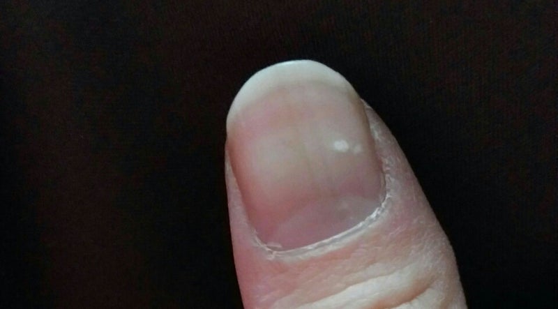 琉球手相 指の爪に出現する白点 カーラのブログ