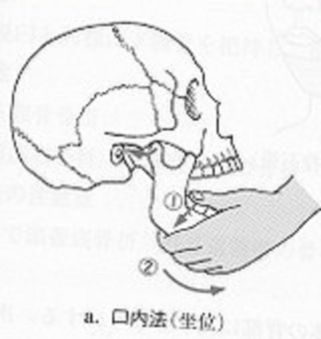 顎関節脱臼 | 京都市北区＊和田針灸接骨院のブログ