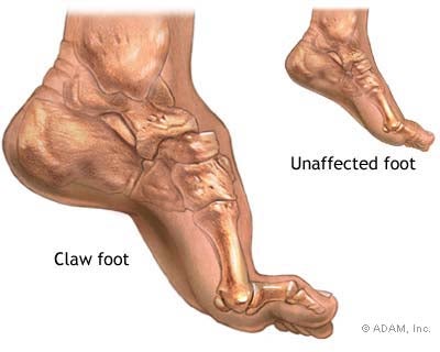 が 足 痛い 甲 の 足首から足先に関する痛み