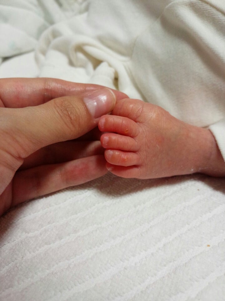 [10000ダウンロード済み√] 赤ちゃん 足の指 湿疹 302636赤ちゃん 足の指 湿疹