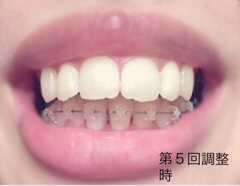 ちょっと並べてみようの記事画像