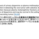 褐色細胞腫のスクリーニングの検査についての記事より