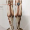 膝裏の痛みの画像